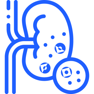 Diabetes Renal failure